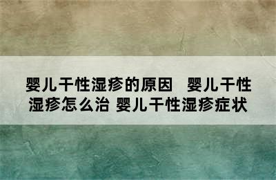 婴儿干性湿疹的原因   婴儿干性湿疹怎么治 婴儿干性湿疹症状